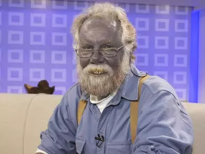 Man Turns Blue After Taking Supplements