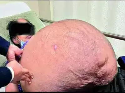 woman with tumour