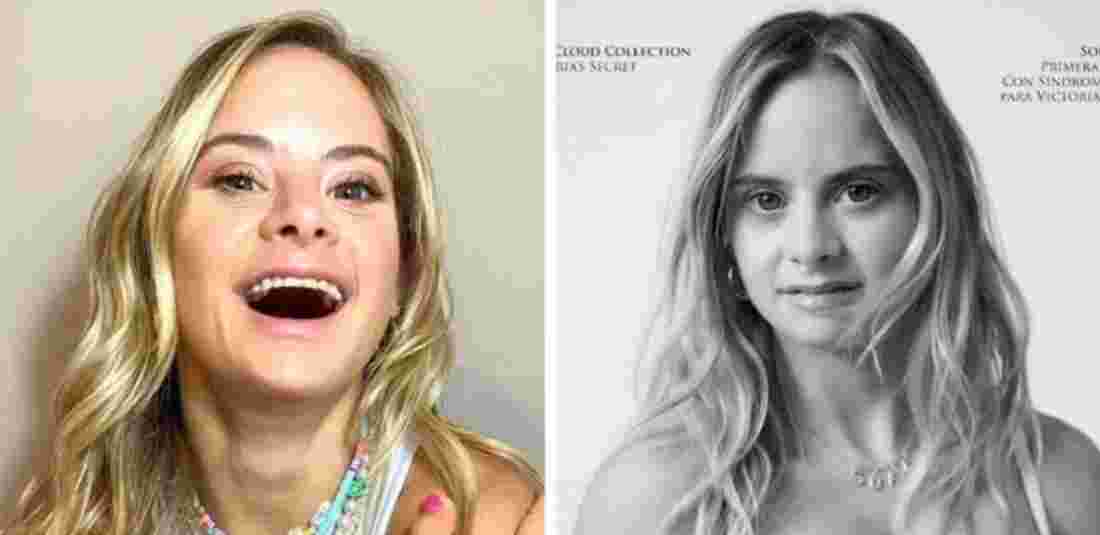 Victoria Secrets Introduces First Model With Downs Syndrome 