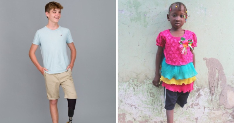 Young girl who received prosthetic leg from Vodafone Healthline