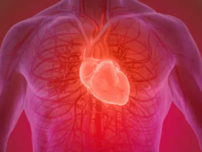New AI Process Can Detect Plaque Erosion In Heart, Could Help Avoid Heart Attacks