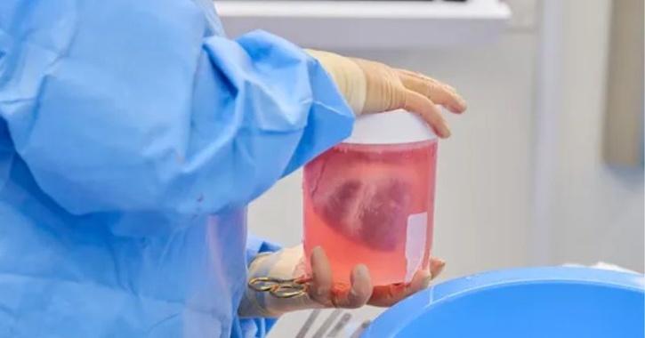 Hati Babi Rekayasa Genetik Ditransplantasikan ke Tubuh Manusia Mati