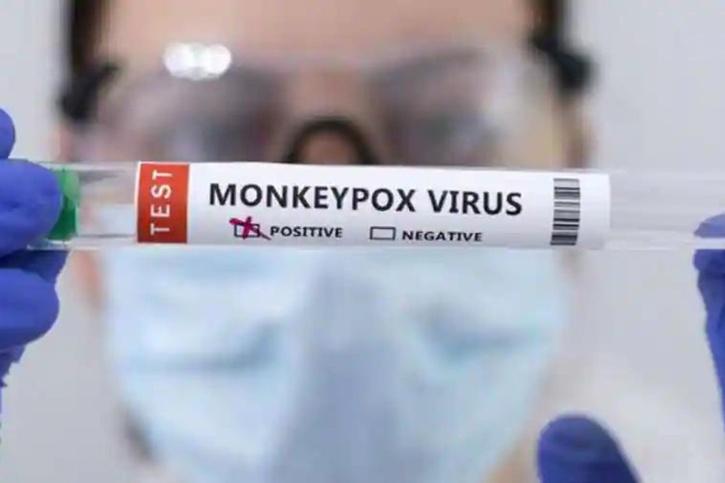 Monkeypox: Symptoms, Treatment And Vaccine
