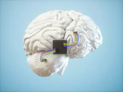 A Startup Beat Elon Musk's Neuralink With Its Brain-Computer Interface Implant