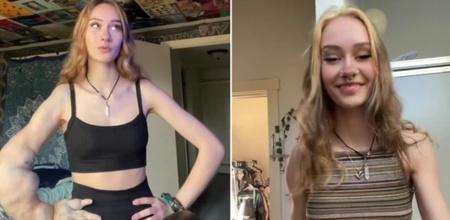Woman Born With Huge Arms Says Strangers Ask Her To Amputate It