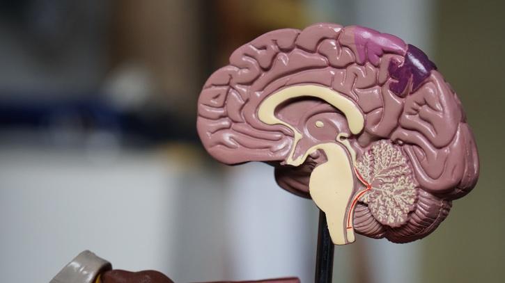 Penemuan Gen Baru Menjelaskan Mengapa Wanita Mengalami Alzheimer