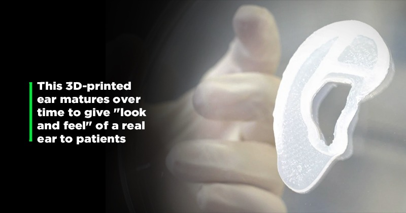 How Doctors 3D-Printed A Functional Ear Using Human Cells For The First ...