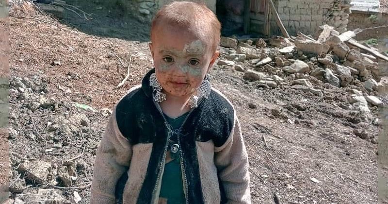 A picture of an Afghan child after the earthquake