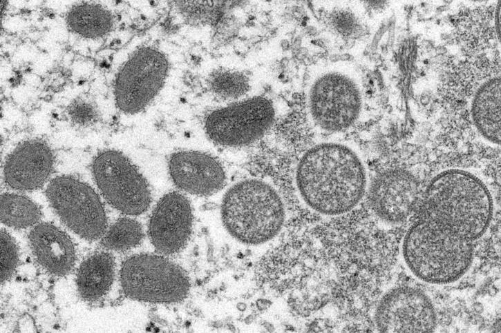 Kasus Monkeypox Diperkirakan Meningkat Secara Global Saat Pengawasan Berkembang, Kata WHO