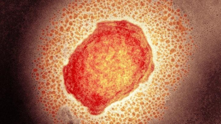 monkeypox virus