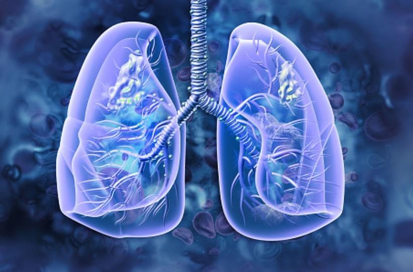 Study Finds Link Between Air Pollution And Lung Cancer; Explains Why Non- Smokers Get Disease