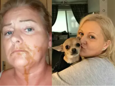 Dog poops on woman's face 