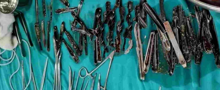 uttar pradesh doctors remove 63 spoons from patient stomach