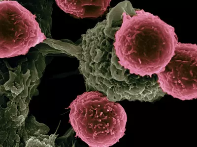 Scientists Saved Cancer Patient's Life By Using Modified Virus To Kill Tumour