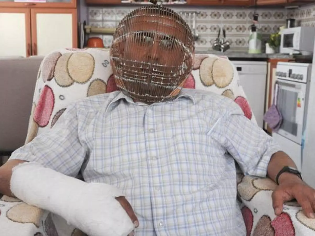Story Of Turkish Man Who Caged His Head To Quit Smoking