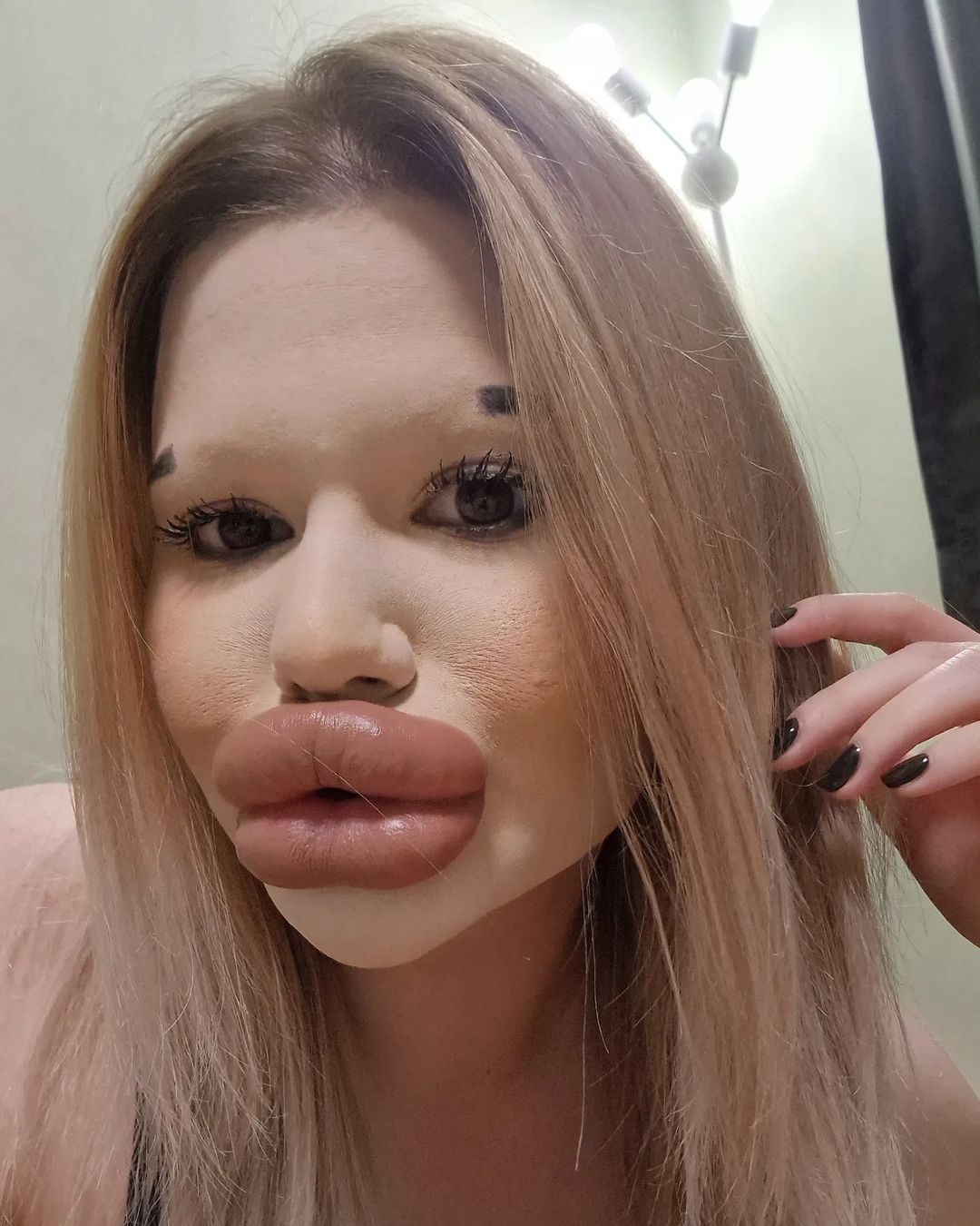 Woman With Worlds Biggest Lips Says She Cant Find Love Of Her Life pic