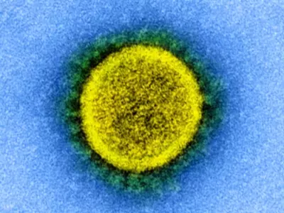 A Highly Mutated Version Of The Covid Virus Ba.2.86 Has Been Found In Several Countries