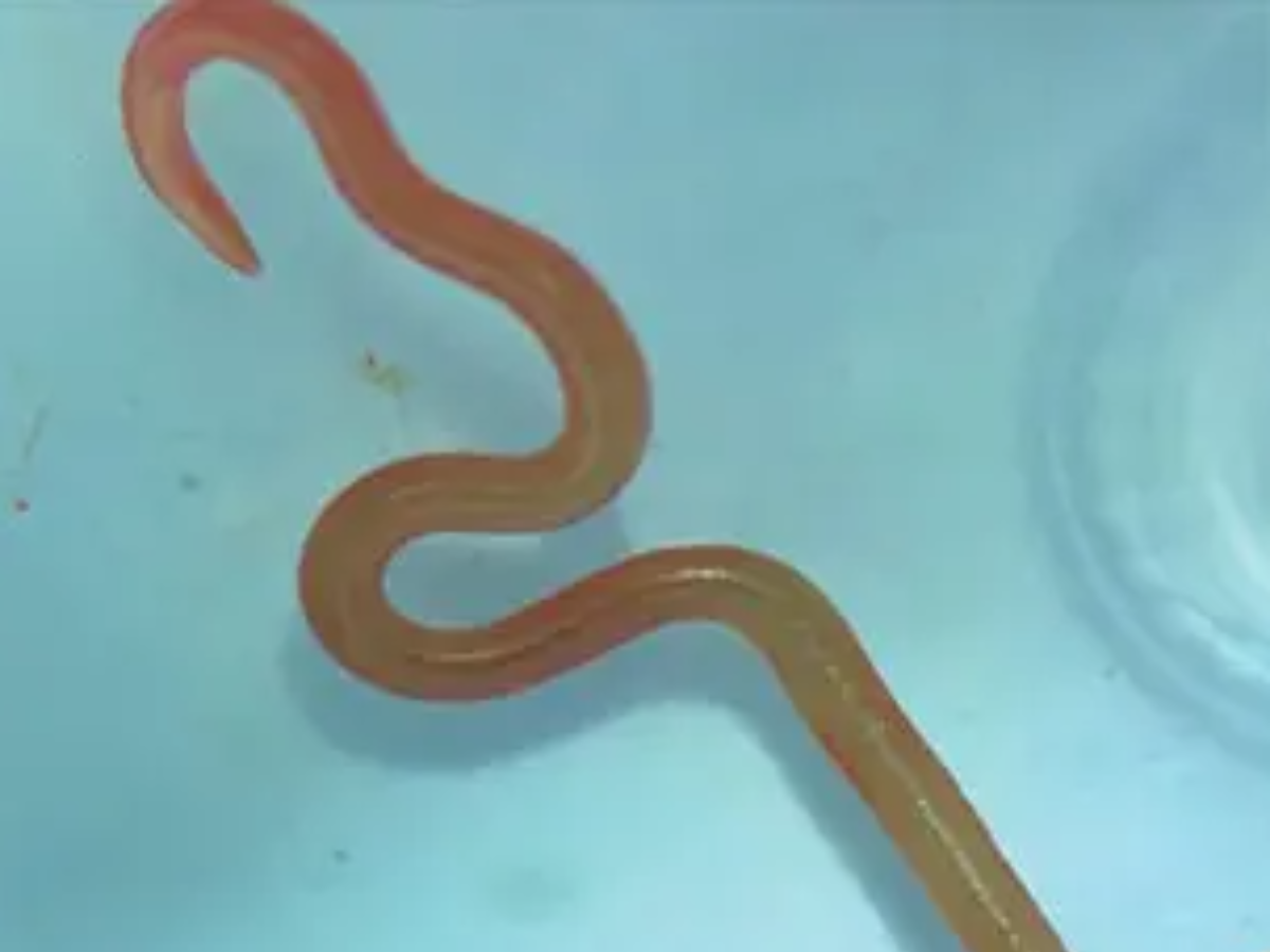 Living Worm Found In Woman