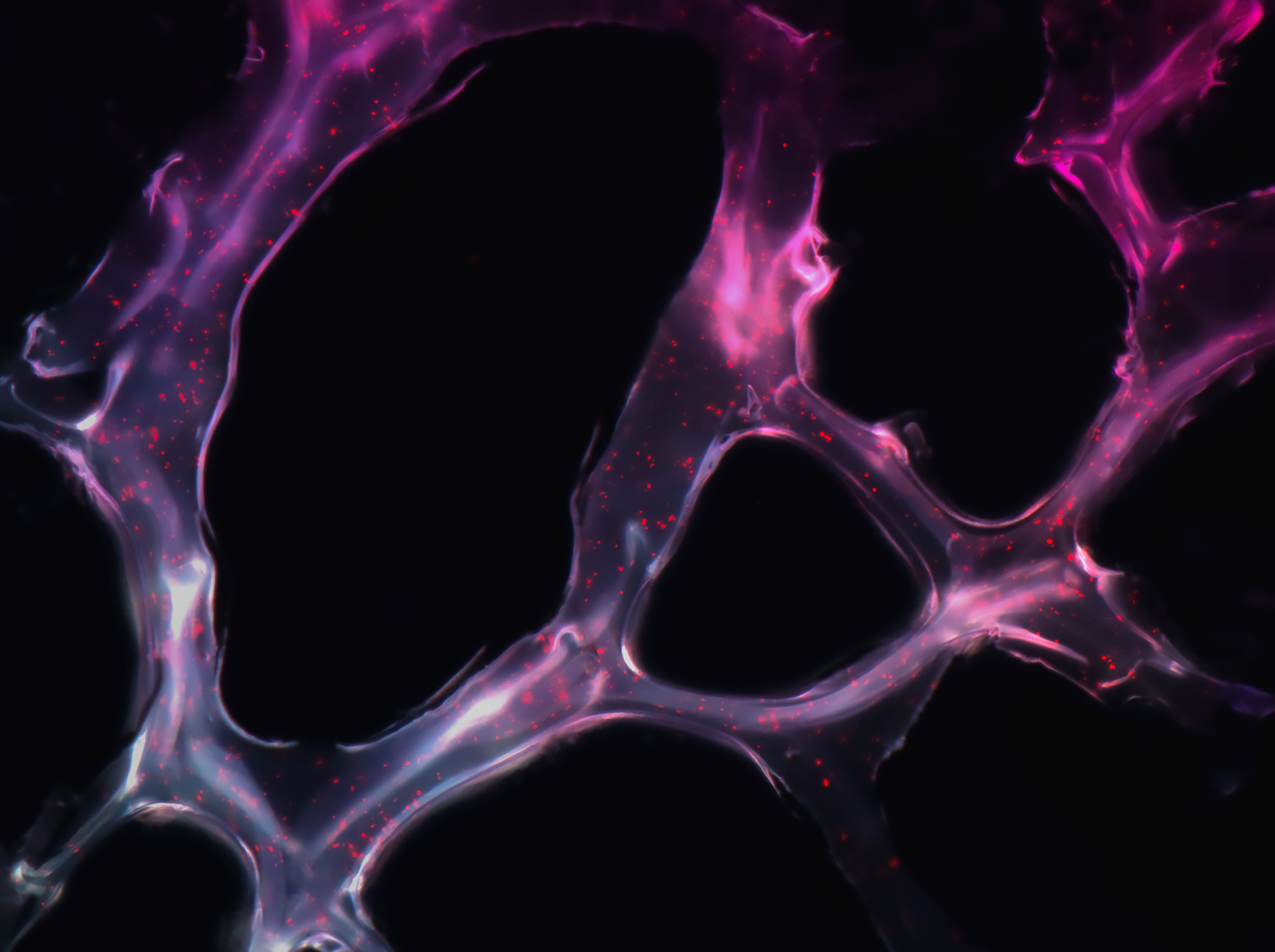 Researchers Use Sound Waves To Target And Destroy Cancer Tumours