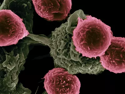 Artificial Intelligence Developed 'Words' That Instruct Cells To Kill Off Cancer