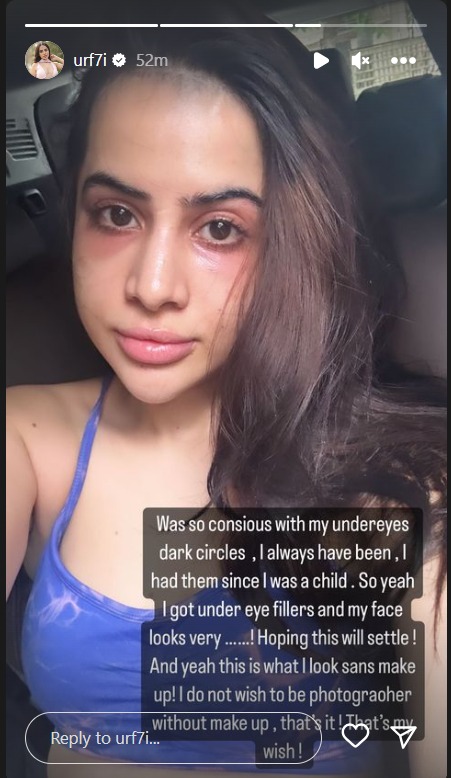 'Do Not Wish To Be Photographed Without Make Up': Uorfi Javed Shares ...