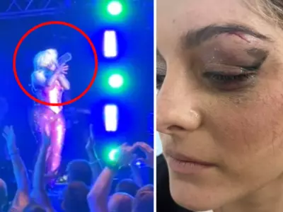 Man Purposely Threw Phone At Bebe Rexha's Face During Concert As He 'Thought It Would Be Funny'