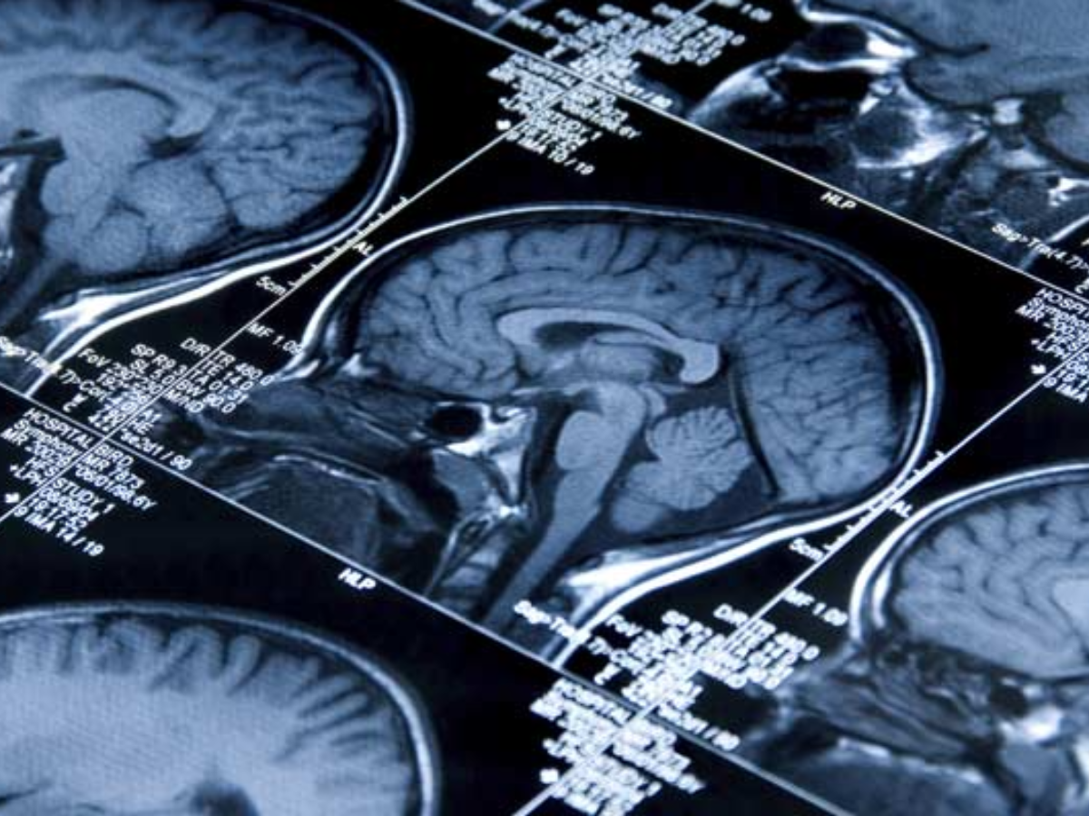 New Study Shows This Diet Can 'De-Age' Your Brain By Nearly A Year: All ...