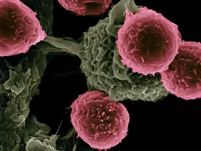 Revolutionary 'Microscopic Aircraft Carrier' Delivers Targeted Cancer Treatment