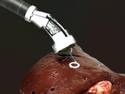 This Robotic Arm Can Perform Surgery And 3D Print Inside The Human Body