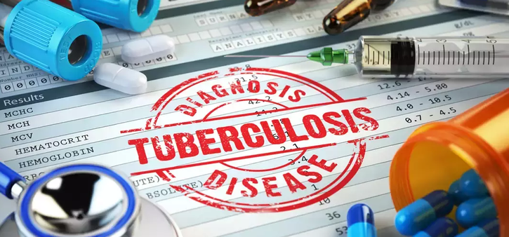 diagnose tuberculosis disease