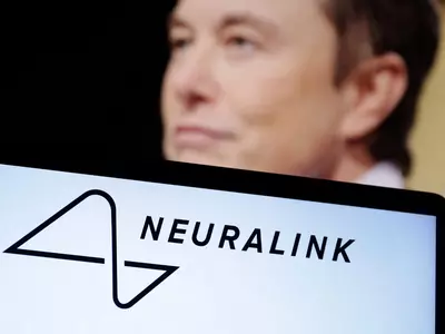 Elon Musk's Neuralink Brain Chip Gets FDA Approval For Human Trials