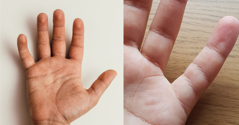 5 Things a Man's Finger Length Says About Him | Live Science