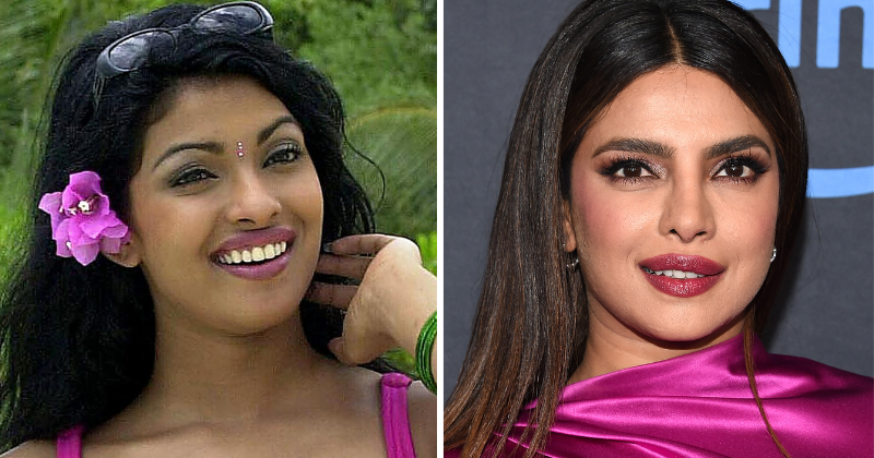 Madhu Chopra Shares How Priyanka Chopra's Nose Surgery Went Wrong & Her ...