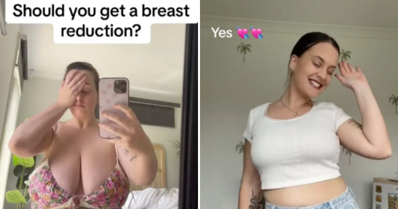 Why Gen Z Women Are Getting Breast Reduction Surgery And Sharing Their  Stories Online