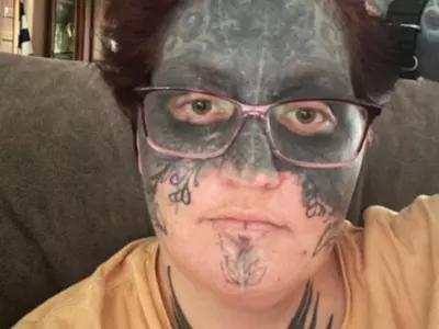 Woman Is Getting Face Tattoo Removed