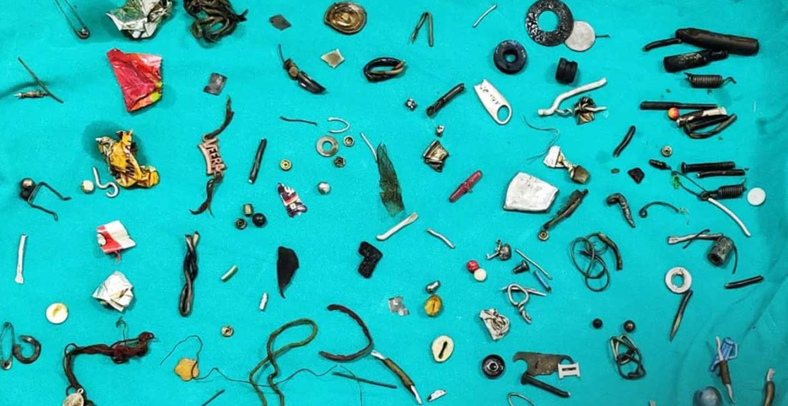 Earphones, Screws rakhi punjab man stomach all about pica disease 