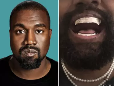 Kanye West Gives His Teeth A Titanium Makeover, Spends More Money Than The Cost Of Your House