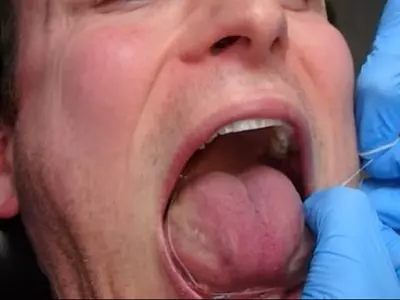 Belgian man expands tongue to 17 centimeters to set Guinness World Record