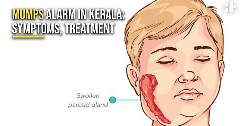 Kerala Mumps Outbreak: What Are The Symptoms And Why Kerala Often ...