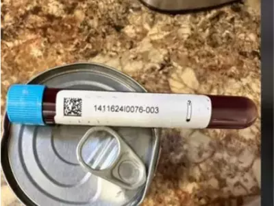 Shein Customer Receives Vial Of Blood And Beans