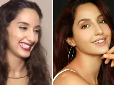 Nora Fatehi Before Surgery? Old Video Has People Debating If She Has Gone Under The Knife