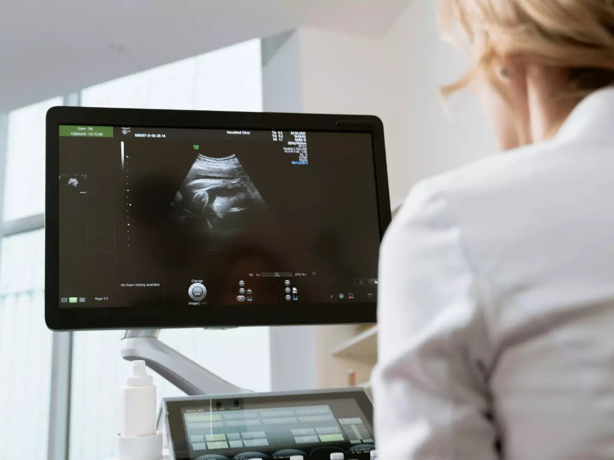 Doctors successfully remove a 9.1-kg tumour from a 55-year-old woman; could this happen to me? Know what experts say