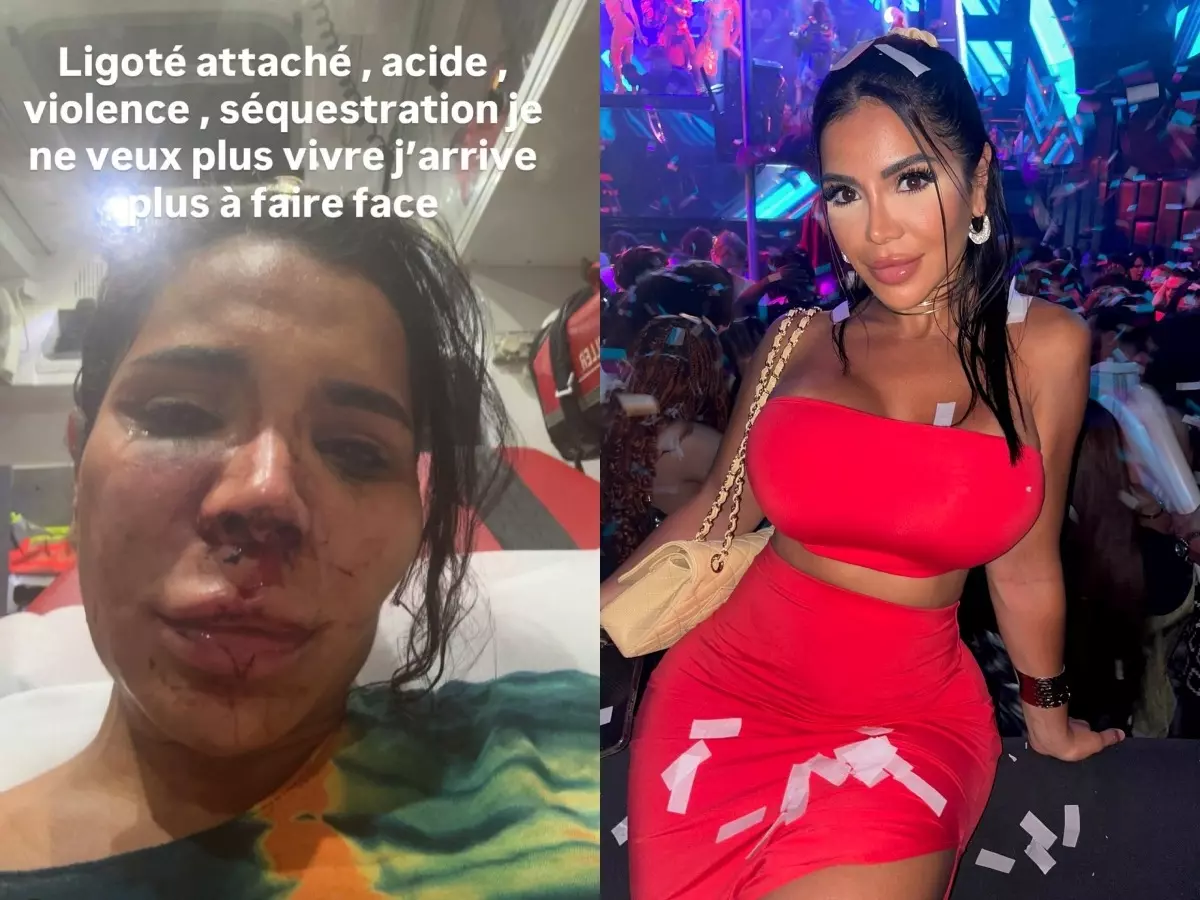 Who is Soraya Riffy? French influencer sexually assaulted, ‘disfigured