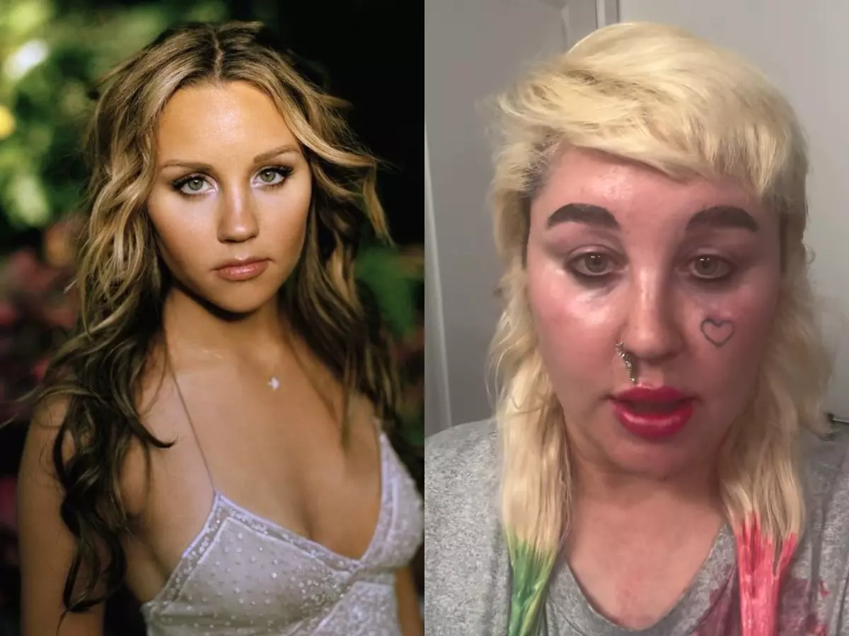 Amanda Bynes reveals she¡¯s starting Ozempic Amanda Bynes reveals she¡¯s starting Ozempic