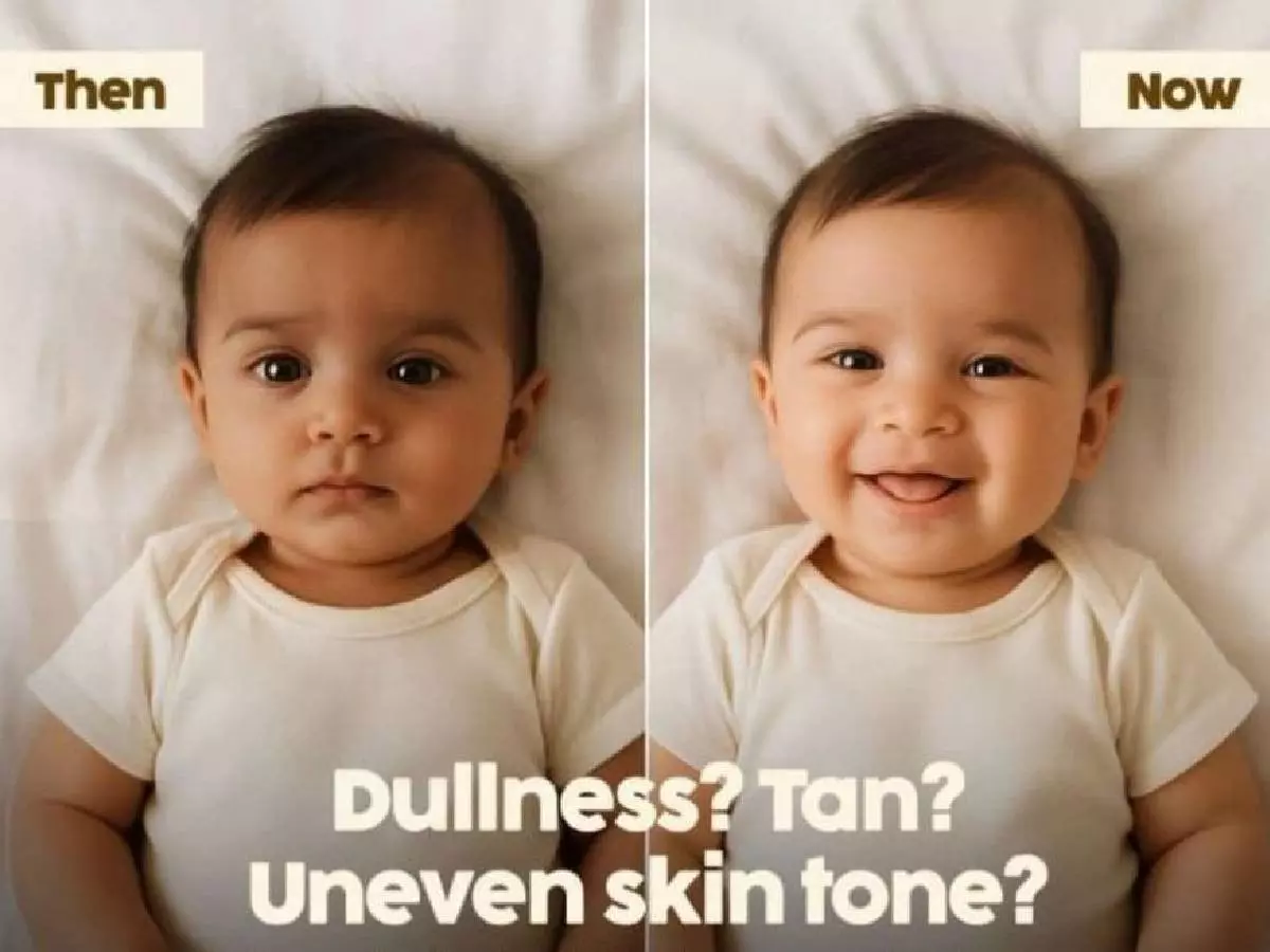 Baby ¡®tan¡¯ product gets dragged online after viral post | Credit: LinkedIn/Shantesh S Row Baby ¡®tan¡¯ product gets dragged online after viral post | Credit: LinkedIn/Shantesh S Row