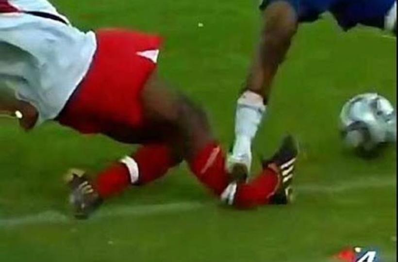 worst sports injuries of all time
