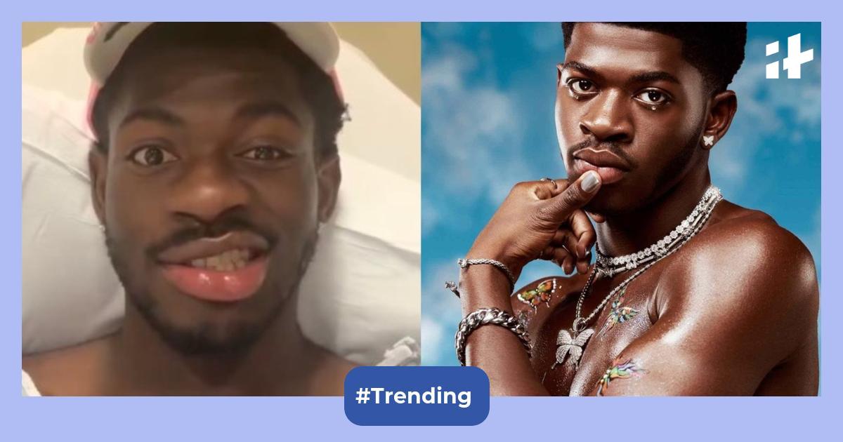 ‘Can’t even laugh right’: After Justin Bieber, Lil Nas X diagnosed with facial paralysis; experts reveal 5 possible causes