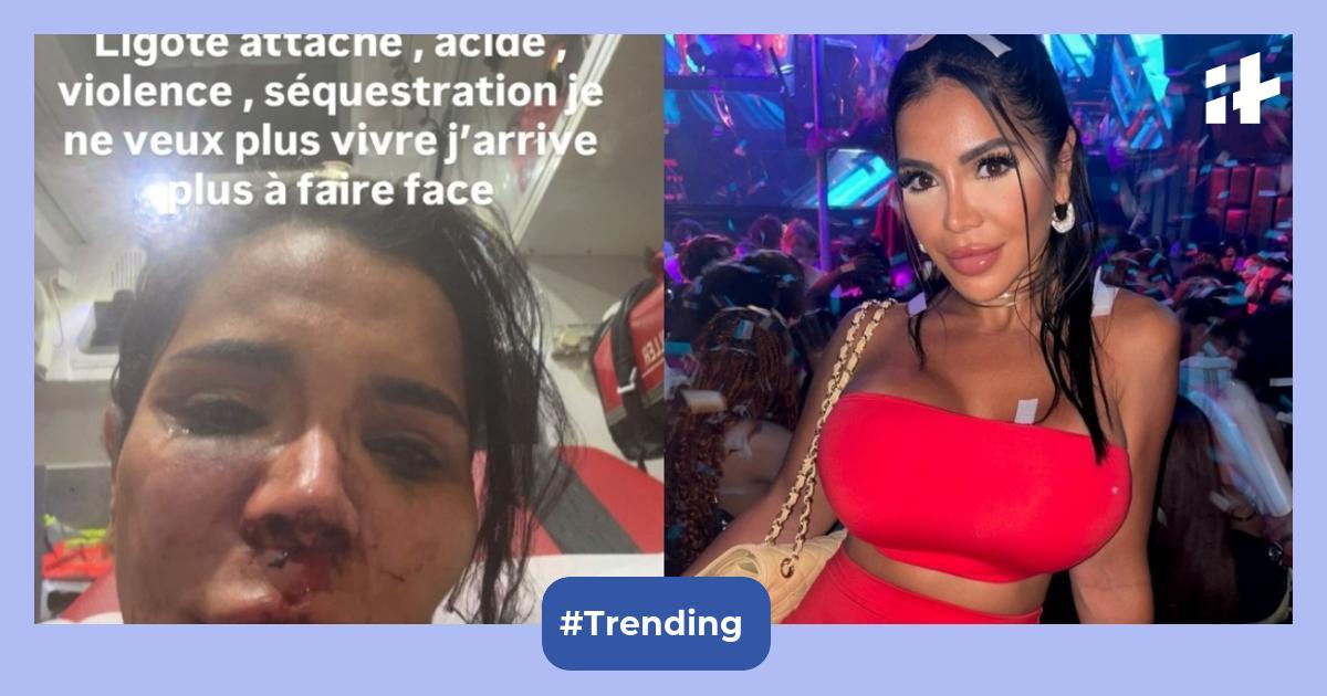 Who is Soraya Riffy? French influencer sexually assaulted, ‘disfigured