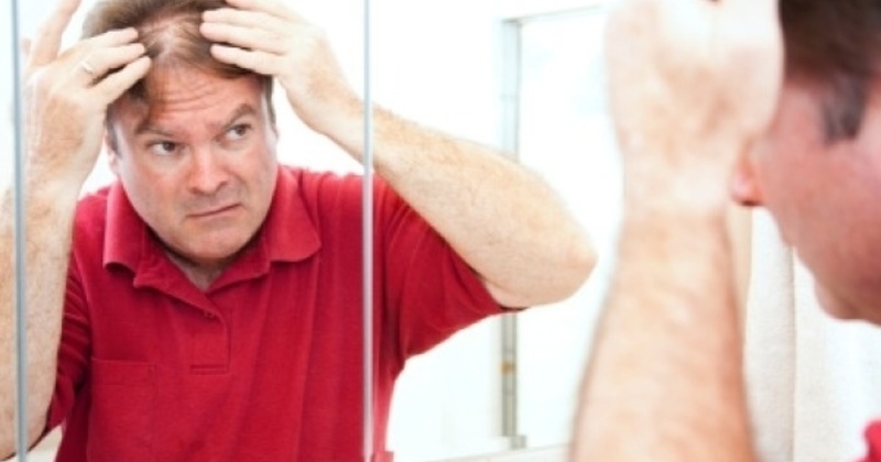 Reasons For Patchy Hair Loss In Men Health Living