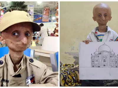 He Suffers From Progeria And Won't Live Long, But Nihal Bhatla's Spirit And Attitude Will Live On Forever